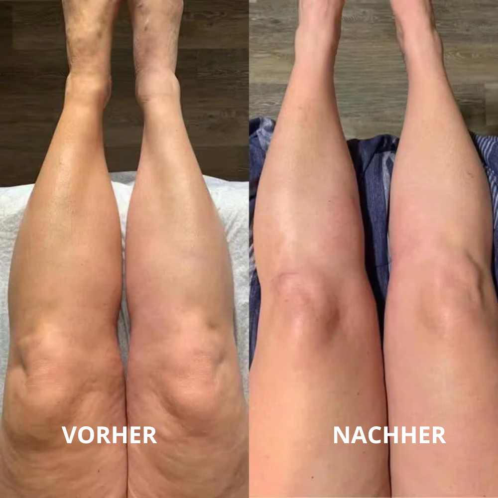 Lymph-Tropfen