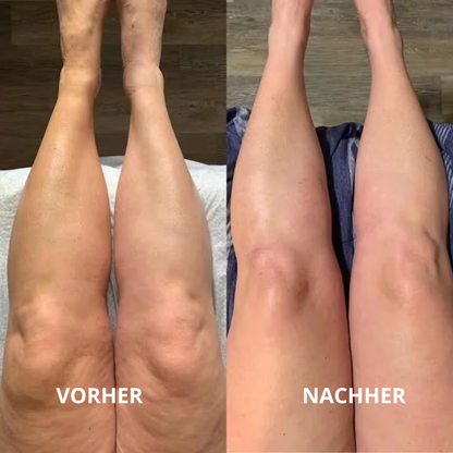 Lymph-Tropfen