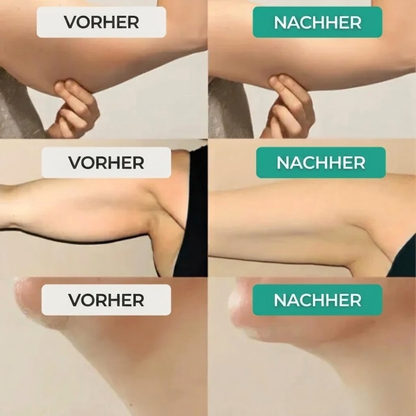 Lymph-Tropfen